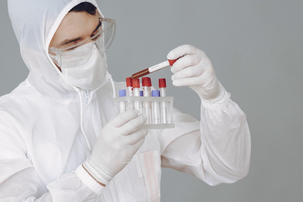 1-3-BETA-GLUCAN ASSAY