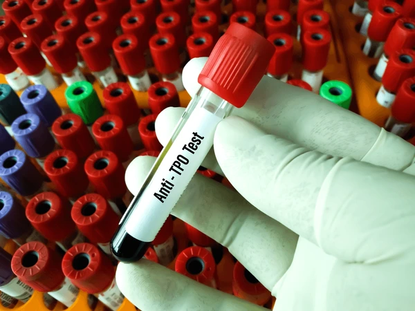 ATG ANTI THYROGLOBULIN